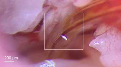 Cochlea
